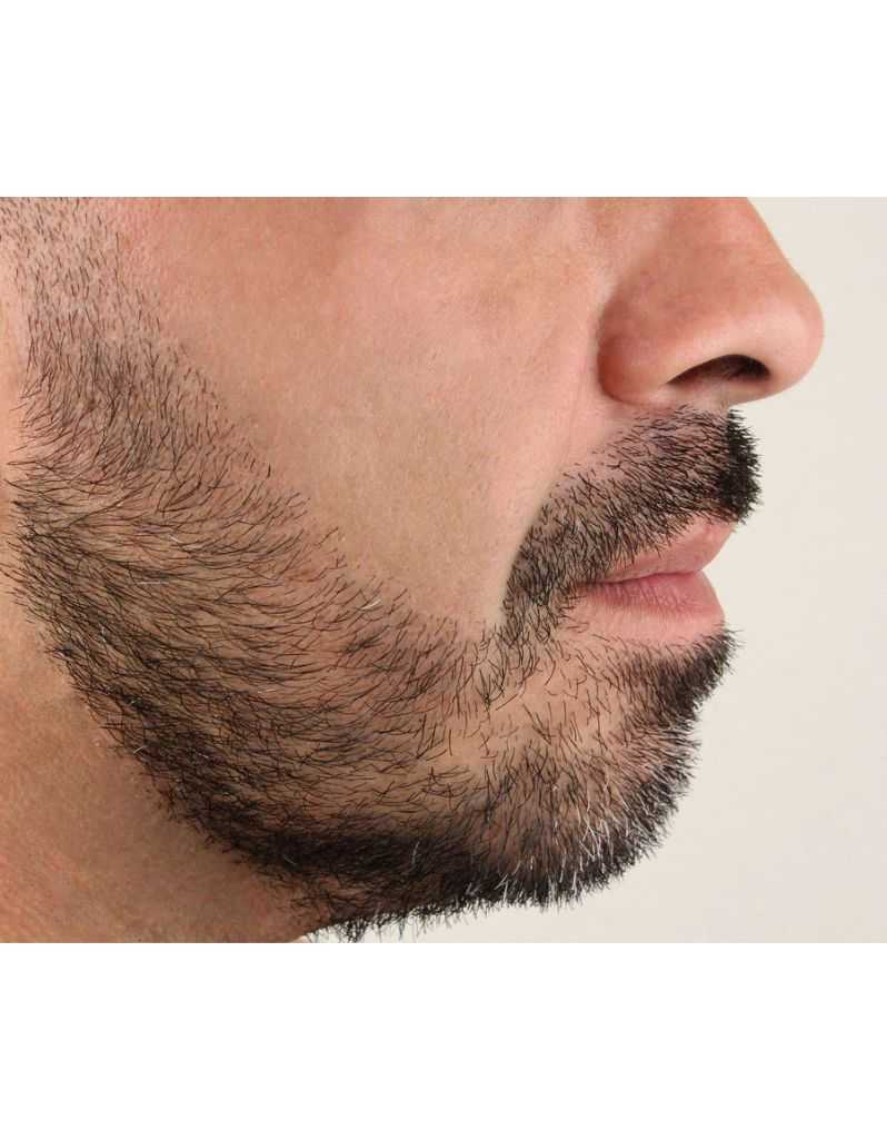 Close-up of a man's beard, shaped with a nape razor  and part of his face on a white background